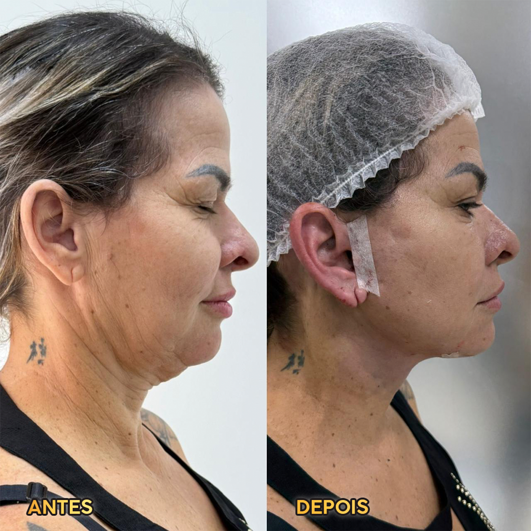 Renata, 42 – Brasília/DF